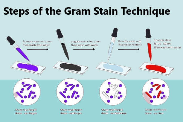 Principle Of Gram Staining 2023 » Flair Pharma The Knowledge Kit.